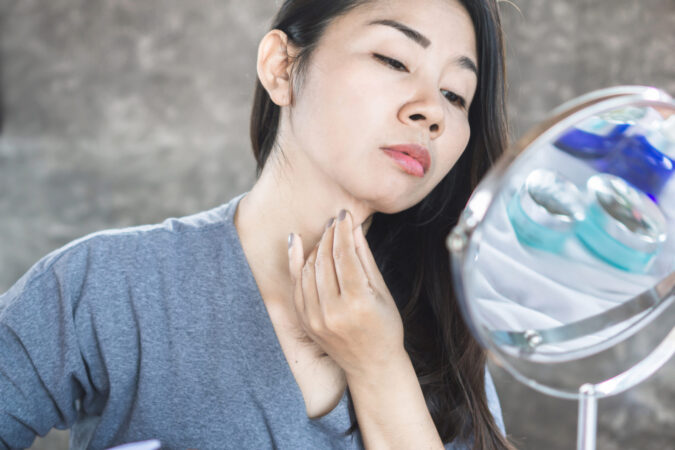 Se défaire de son double menton